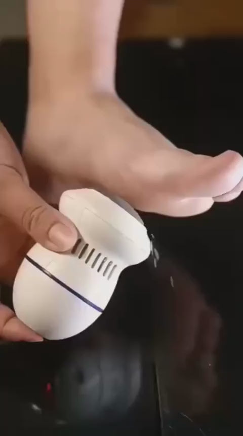 Load video: Foot Pedicure Grinder Remover Tools Automatic Polisher | Dead Skin Callus Feet Care Cleaning | PEDICURE MACHINE Rechargeable Foot Scrubber Tool